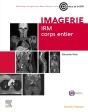 Imagerie : Irm Corps Entier - Preview