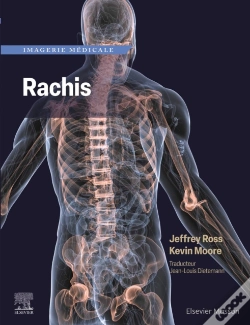 Capa do artigo Imagerie Medicale : Rachis