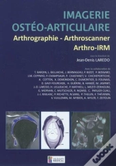 Imagerie Ostéo-Articulaire ; Arthrographie, Arthroscanner, Arthro-Irm