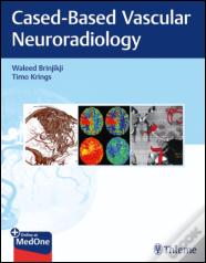 Imaging in Neurovascular Disease