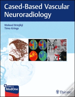 Capa do artigo Imaging in Neurovascular Disease