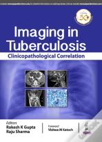 Imaging In Tuberculosis