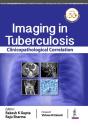 Imaging In Tuberculosis - Preview