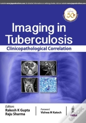 Imaging In Tuberculosis