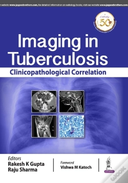 Capa do artigo Imaging In Tuberculosis