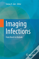 Imaging Infections
