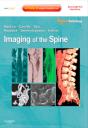 Imaging Of The Spine E-Book - Preview