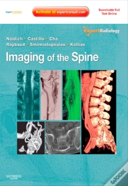 Capa do artigo Imaging Of The Spine E-Book