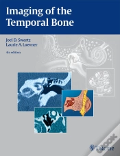 Capa do artigo Imaging Of The Temporal Bone
