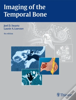 Capa do artigo Imaging Of The Temporal Bone