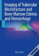 Imaging Of Trabecular Microfracture And Bone Marrow Edema And Hemorrhage