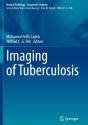 Imaging Of Tuberculosis - Preview