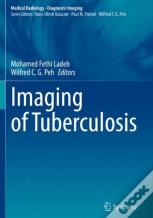 Imaging Of Tuberculosis
