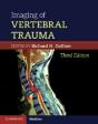 Imaging Of Vertebral Trauma - Preview