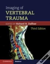 Imaging Of Vertebral Trauma