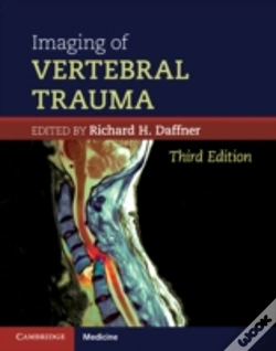 Capa do artigo Imaging Of Vertebral Trauma