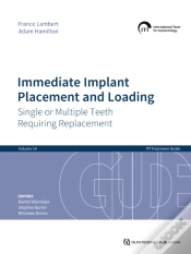 Capa do artigo Immediate Implant Placement And Loading - Single Or Multiple Teeth Requiring Replacement