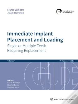 Capa do artigo Immediate Implant Placement And Loading - Single Or Multiple Teeth Requiring Replacement