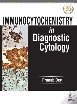 Capa do artigo Immunocytochemistry In Diagnostic Cytology