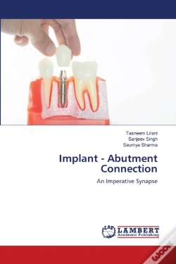 Capa do artigo Implant - Abutment Connection