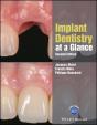 Implant Dentistry At A Glance - Preview
