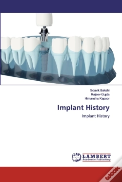 Capa do artigo Implant History