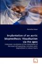 Implantation Of An Aortic Bioprosthesis - Preview