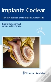 Capa do artigo Implante Coclear