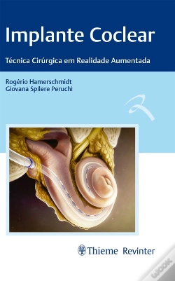 Capa do artigo Implante Coclear