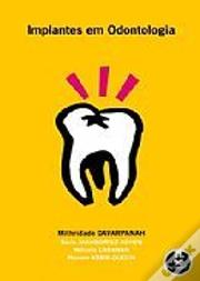 Implantes em Odontologia