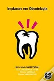 Capa do artigo Implantes em Odontologia