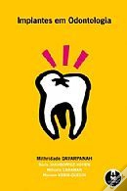 Capa do artigo Implantes em Odontologia