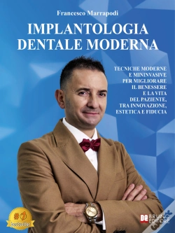 Capa do artigo Implantologia Dentale Moderna
