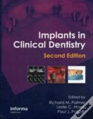 Implants In Clinical Dentistry