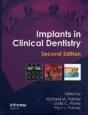 Implants In Clinical Dentistry - Preview