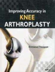 Improving Accuracy In Knee Arthroplasty