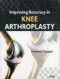 Improving Accuracy In Knee Arthroplasty - Preview