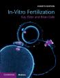 In-Vitro Fertilization - Preview