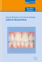 Indirect Restorations - Preview