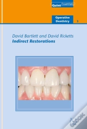 Capa do artigo Indirect Restorations