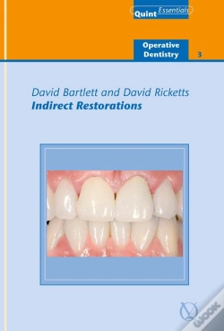 Capa do artigo Indirect Restorations