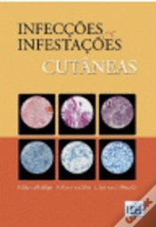 Capa do artigo Infecções e Infestações Cutâneas
