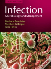 Capa do artigo Infection