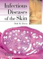 Infectious Diseases Of The Skin - Preview