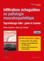 Infiltrations Echoguidees En Pathologie Musculosquelettique - Preview