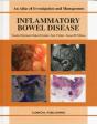 Inflammatory Bowel Disease - Preview