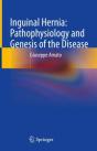 Inguinal Hernia: Pathophysiology And Genesis Of The Disease - Preview