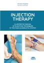 Injection Therapy - Preview