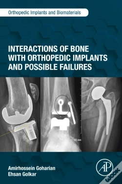 Capa do artigo Interactions Of Bone With Orthopedic Implants And Possible Failures