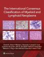 International Consensus Classification Of Myeloid And Lymphoid Neoplasms\ - Preview
